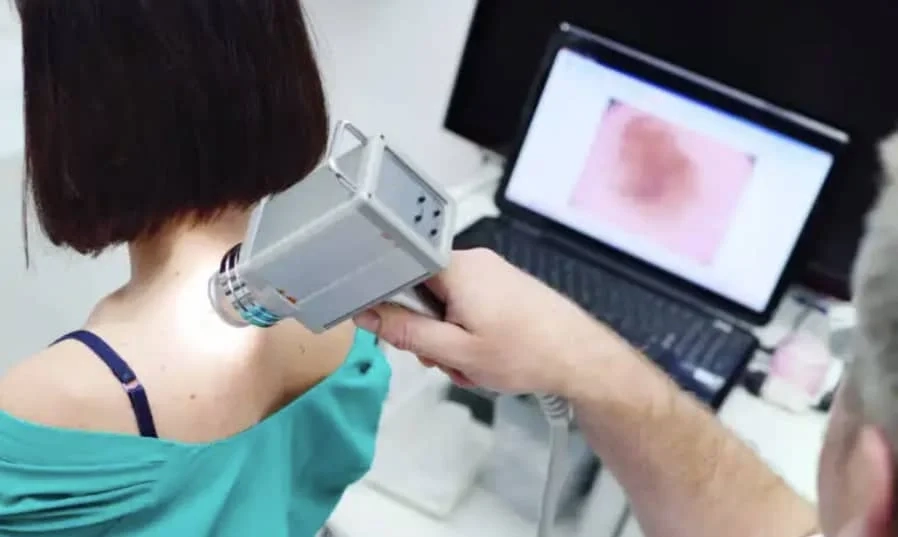 Dermatoscopia Digital